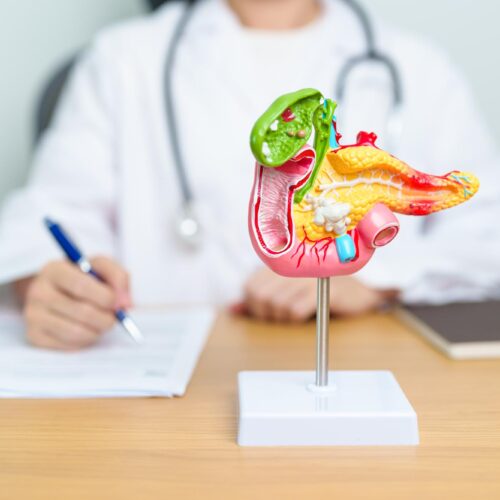 Imagine cu un model anatomic de vezică biliară. In fundal se poate observa un medic ce ia notite cu privire la simptomele de colecistita