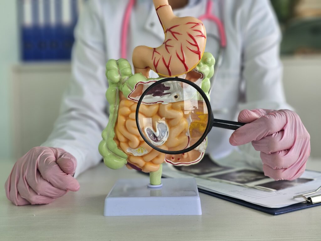 medic care analizează modificări de tranzit cu o lupă