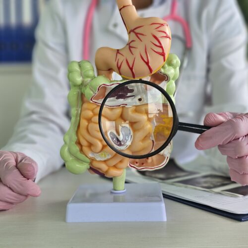 medic care analizează modificări de tranzit cu o lupă
