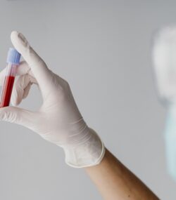 mana unui medic cu manusa chirurgicala tine o proba proba de sange pentru analize de sanatate