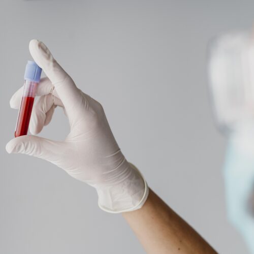 mana unui medic cu manusa chirurgicala tine o proba proba de sange pentru analize de sanatate